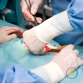 Laparoscopic Hernia Surgery