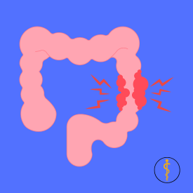 Laparoscopic Colorectal Surgery